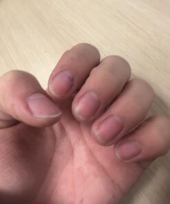 Nutra Nail 5 to 7 Day Growth Treatment - Fast Keratin Nail Hardener & Nail Strengthener for Thin Nails, Brittle & Damaged (0.47 Fl Oz) 0.50 Fl Oz (Pack of 1) 31 618BK ZO7nL 1