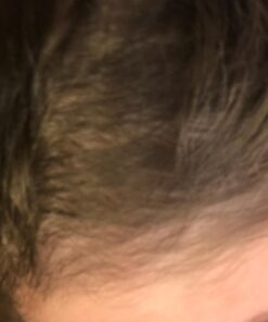 Saw Palmetto & Cayenne Scalp Oil For Hair Growth, Hair Loss Serum, Hair Oil For Dry Damaged Hair And Growth, Hair Growth Serum For Thicker Longer Fuller Healthier Hair, All Natural Vitamin Rich 40 618RndOoYL