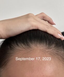 MAJESTIC PURE Castor Oil, 100% Natural Wonder Oil with Numerous Hair, Scalp, Skin and Nails Benefits - Packaging May Vary- 16 fl oz 16 Fl Oz (Pack of 1) 37 618sYBXO7YL