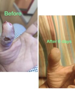 Active Skin Repair Hydrogel - Natural & Non-Toxic First Aid Ointment & Antiseptic Gel for Minor Cuts, Wounds, Scrapes, Rashes, Sunburns, and Other Skin Irritations (Single, 3 oz Gel) 3 Fl Oz (Pack of 1) 35 619 u6F7SjL