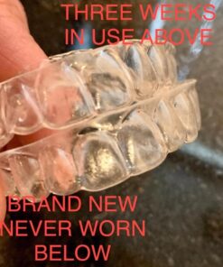 Retainer Brite Tablets for Cleaner Retainers and Dental Appliances - 96 Count 96 Count (Pack of 1) 25 619UnSzMI5L