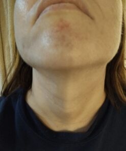 DIM Supplement 200 mg | Estrogen Hormone Balance for Women & Men | Hormonal Acne Supplements, Menopause Support, Antioxidant Support | Clean Label Project Certified, Vegan, Soy Free | 60 Ct. DIM 200mg 45 619UoRAlfrL 1