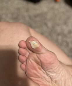 Compound W Maximum Strength Fast Acting Liquid Wart Remover, 0.31 fl oz 36 619yJe odlL