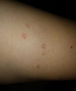 PURELY NORTHWEST-Natural Tea Tree & Peppermint Body Wash for Men & Women-Refreshing Daily Soap for Body Odor & Hygiene, Acne-Effectively Soothes Jock Itch, Chafing & Athletes Foot-Discolored Nails-9oz 9 Fl Oz (Pack of 1) 62 61ALK8X 3dL