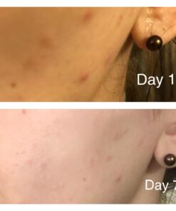 Tree of Life Retinol Serum for Face w/Hydrating Hyaluronic Acid for Wrinkle Soothing, Fine Lines & Dark Spots - 2 Fl Oz - Renew & Reset Nighttime Serums - Dermatologist Tested Facial Skin Care 2 Fl Oz (Pack of 1) 49 61AQPKi3nL