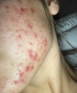 SeoulCeuticals Korean Skin Care 20% Vitamin C Hyaluronic Acid Serum + CE Ferulic Acid - Potent Anti Aging, Anti Wrinkle Korean Beauty 1oz 49 61AqONFrSAL 1