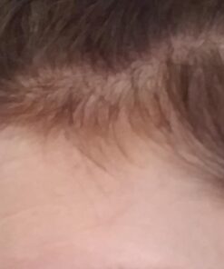 Nature's Bounty Optimal Solutions Hair Skin & Nails Extra Strength Softgels, 150 Count (Pack of 1) Package may vary 40 61BWtC8puEL