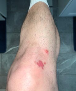 Silver Miracles Colloidal Silver Gel - Nano Silver Gel Wound Care - Healing Ointment for Burns, Sunburns & Irritated Skin - 4 Oz Unscented 39 61BXHfCqAcL 1