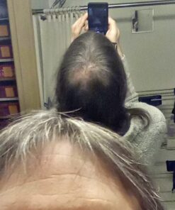 6 Months Kirkland Minoxidil 5% Extra Strength Hair Loss Regrowth Treatment Men, 12 Fl Oz (Pack of 6) 42 61CKrOpAb3L