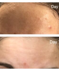 Tree of Life Retinol Serum for Face w/Hydrating Hyaluronic Acid for Wrinkle Soothing, Fine Lines & Dark Spots - 2 Fl Oz - Renew & Reset Nighttime Serums - Dermatologist Tested Facial Skin Care 2 Fl Oz (Pack of 1) 50 61CRt6QGO0L