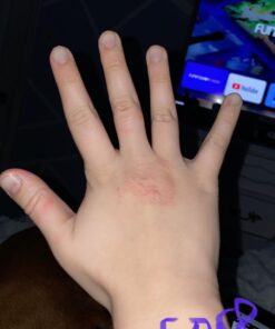 Eucerin Baby Eczema Relief Body Cream - Steroid & Fragrance Free for 3+ Months of Age - 5 oz. Tube 36 61CgaCwAneL