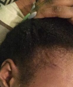 Wild Growth Hair Oil 3pcs x 4oz 4 Fl Oz (Pack of 3) 26 61ClwgGaR7L