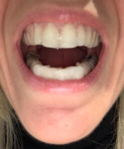 Dental Duty Sensitive Teeth Whitening Strips – Professional Vegan Stain Remover White Strips for Sensitive Teeth for Coffee & Tea Stains – Get A Lighter Shade After One Application – 28 Strips 44 61CqdsLorL