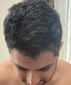 6 Months Kirkland Minoxidil 5% Extra Strength Hair Loss Regrowth Treatment Men, 12 Fl Oz (Pack of 6) 38 61DAHY9l2UL