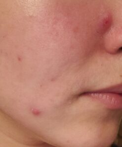 Paulas Choice--SKIN PERFECTING 2% BHA Liquid Salicylic Acid Exfoliant--Facial Exfoliant for Blackheads, Enlarged Pores, Wrinkles & Fine Lines, 4 oz Bottle 4.00 Fl Oz (Pack of 1) 35 61DCZ5UhX4L