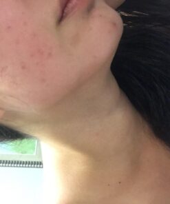 Palmer's Cocoa Butter Formula Skin Therapy Oil - Face, 1 fl oz 15 61DDxMLdFvL