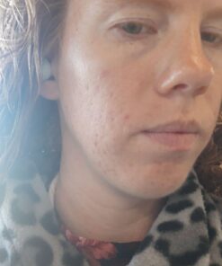 Silver Miracles Colloidal Silver Gel - Nano Silver Gel Wound Care - Healing Ointment for Burns, Sunburns & Irritated Skin - 4 Oz Unscented 38 61DKKEqeJhL