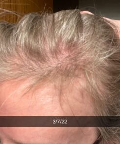 BeLive Biotin Gummies with MultiVitamins, Folate, Inositol – Supports Hair Growth, Healthy Skin & Nails – Vegan, Pectin Based – Strawberry Flavor (1) 60 Count (Pack of 1) 34 61DWa3Wd9L