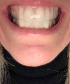 Dental Duty Sensitive Teeth Whitening Strips – Professional Vegan Stain Remover White Strips for Sensitive Teeth for Coffee & Tea Stains – Get A Lighter Shade After One Application – 28 Strips 45 61EJbsI4PML