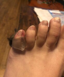 Natracure Advanced Gel Toe Separator (w/Toe Loop) - Spacer, Corrector, Straightener to Cushion and Align Bent, Crooked, Overlapping Toes - Corns, Pinky Tailor Bunions - (1104-M CAT 2PK) - Size: Small Small (Pack of 2) 16 61FiCsQfxGL