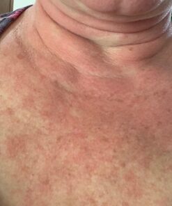 NOW Supplements, Niacin (Vitamin B-3) 500 mg, Essential B-Group Vitamin*, Nutritional Health, 100 Capsules 100 Count (Pack of 1) 25 61H0IUCSlHL