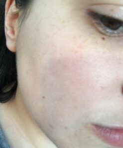 Hydrating Face Moisturizer & Body Cream with Manuka Honey Cream - Organic Face Moisturizer & Body Lotion for Extremely Dry Skin - For Dry & Itchy Skin, Rosacea & Eczema Prone Skin (Original, 2oz) Original 2 Ounce (Pack of 1) 38 61H7GygbDeL 1