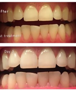 Whitening Tooth Powder with Activated Charcoal for Teeth and Gums (Cool Peppermint) - Safe on Enamel, Detoxifying, Plant-Based and Cruelty Free 2.75 Ounce (Pack of 1) 34 61HJur27IZL