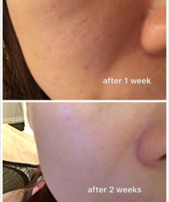 Labo Labo Super Pores Lotion, 200ml 3 61HYqTeJhTL