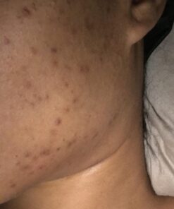 Jarrow Formulas Milk Thistle 150 mg With 30:1 Standardized Silymarin Extract, Dietary Supplement for Liver Function Support, 200 Veggie Capsules, 66-200 Day Supply 200 Servings (Pack of 1) 55 61HfCswYAxL