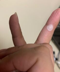 Dr. Scholl's Clear Away WART Remover HYDROGEL Bandage // 12 Discs/9 Cushions, Clinically Proven, Immediate & All-Day Cushioning Pain Relief, Multi-Day Coverage, 12 Treatments 29 61HlNk22EpL