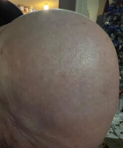 Head Shaver for Bald Men,5 in 1 Bald Head Shavers for Men Cordless,Waterproof Wet/Dry 5 Head Mens Electric Razor for Head Face Shaving, USB Mans Grooming Kit Rechargeable,Rotary Shaver Gift for Men 38 61HnyBIDaQL