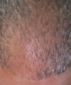 iRestore Essential Laser Hair Growth System - FDA Cleared Hair Loss Treatments for Men & Women & Hair Growth Products for Men with Thinning Hair, Hair Regrowth Treatments Laser Cap, Red Light Therapy 38 61IBH8ur5ML 1