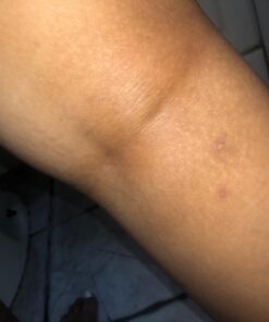 Organic Aloe Vera Gel - 100% Pure for Skin, Sunburn Relief & Face Moisturizer - Extracted from Aloe Vera Plant with Manuka Honey, Orchid & Apple Stem Cells - Everyday Use - 8 Fl Oz 8 Fl Oz (Pack of 1) 40 61IYS5QjUOL