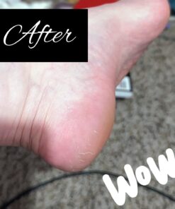 Microplane Colossal Foot File Scraper - The Original Stainless Steel Foot Rasp, Dead Skin/Callus Remover for Feet, Gentle Foot Scrubber, Pedicure Tools for Salon-Quality Foot Care, Black 79 61Iixkkda7L