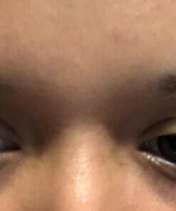 Emjoi Tweeze erase e6, Facial Hair Remover, Epilator 18 61J94XTWwvL