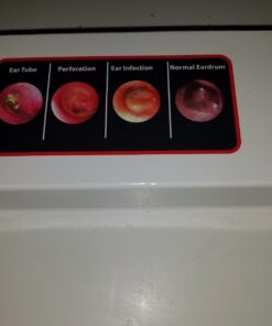 【Lifetime Warranty】4th Generation Doctor Mom LED Pocket Pro Otoscope with both Adult and Pediatric Disposable Specula Tips, Battery, and Protective Hard Plastic Case 30 61JQG57c0VL