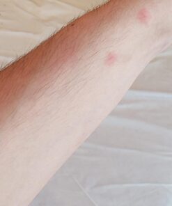 Alternative view of Ortho Home Defense Dual-Action Bed Bug Killer Aerosol, 18 oz. 1.13 Pound (Pack of 1)