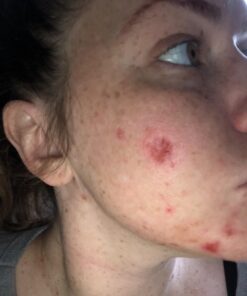 InstaNatural BHA Exfoliating Face Serum, Minimizes Lines, Wrinkles, and Blemishes, with Vitamin C and Salicylic Acid, 1 Fl Oz 31 61KAW9x9TiL