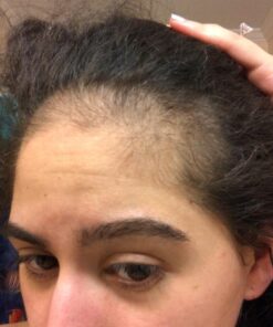 Hairburst Hair Growth Shampoo & Conditioner Set For Women - Vegan Shampoo for Anti Hair Loss & Thinning Hair 32 61KjOZ1xSL