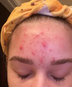 DIM Supplement 200 mg | Estrogen Hormone Balance for Women & Men | Hormonal Acne Supplements, Menopause Support, Antioxidant Support | Clean Label Project Certified, Vegan, Soy Free | 60 Ct. DIM 200mg 62 61Kqc9AvVL