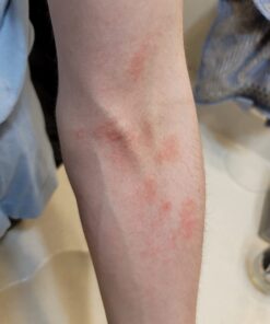 Silver Miracles Colloidal Silver Gel - Nano Silver Gel Wound Care - Healing Ointment for Burns, Sunburns & Irritated Skin - 4 Oz Unscented 49 61Kw3b2KngL 1