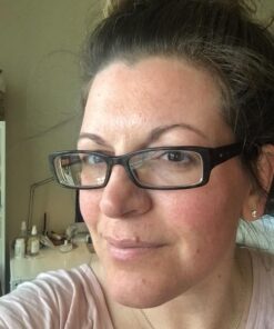 ASTERWOOD NATURALS Pure Vitamin C Facial Serum for Skin Organic Hyaluronic Acid Added; Brightening, Smoothing, Hydrating; Fragrance Free, Paraben Free, 29 ml/1 oz 1 Fl Oz (Pack of 1) 15 61L3pGSNCNL