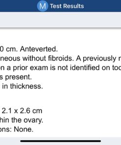 Doctor's Best High Potency Serrapeptase, Non-GMO, Gluten Free, Vegan, Supports Healthy Sinuses, 120,000 SPU, 90 Count 90 Count (Pack of 1) 31 61LBWRo8xRL