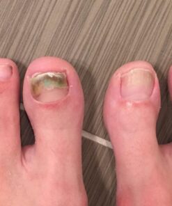 3 in 1 Professional Foot Spa Kit-with Tea Tree Foot & Body Soak-Tea Tree Body Wash & Nail Blend-Soothes Dry, Burning & Itchy Skin-Refreshes Unwanted Foot Odor-Restores Unhealthy Nails-Purely Northwest Tea Tree Oil 3 Piece Set 42 61MtlMy6bQL