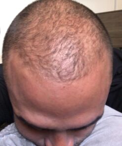 Nutrafol Men's Hair Growth Supplements, Clinically Tested for Visibly Thicker Hair and Scalp Coverage, Dermatologist Recommended - 1 Month Supply 45 61N0h9Cqk L