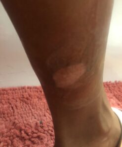 Active Skin Repair Hydrogel - Natural & Non-Toxic First Aid Ointment & Antiseptic Gel for Minor Cuts, Wounds, Scrapes, Rashes, Sunburns, and Other Skin Irritations (Single, 3 oz Gel) 3 Fl Oz (Pack of 1) 45 61NgqtrGAZL