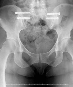 Penetrex Joint & Muscle Therapy – Soothing Relief for Back, Neck, Hands, Feet & Nerves – Maximum Strength Premium Whole Body Recovery Rub with Arnica, Vitamin B6 MSM & Boswellia – Non-Greasy 4oz Cream 4 Ounce (Pack of 1) 41 61O17uo86iL