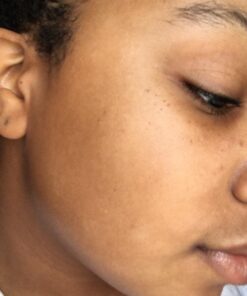 African Black Soap Paste 8 oz. 100% Raw Pure Natural From Ghana. Acne Treatment, Aids Against Eczema & Psoriasis, Dry Skin, Scars and Dark Spots. Great For Pimples, Blackhead, Face & Body Wash. Unscented 8 Ounce (Pack of 1) 52 61PqT3b0LwL