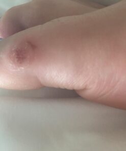 Compound W Maximum Strength Fast Acting Liquid Wart Remover, 0.31 fl oz 50 61QO0aVHDL