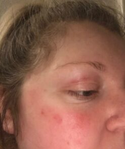 Face Moisturizer for Dry Skin - Facial Moisturizer for Women & Men - Dry Skin Face Moisturizer with Manuka Honey, Aloe Vera & Cehami - Soothing & Redness Relief Face Creams for Sensitive Skin & Eczema 27 61QQgOPNf5L